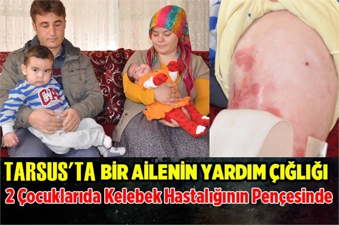 Tarsus'ta Kelebek hastası kardeşler yardım bekliyor!
