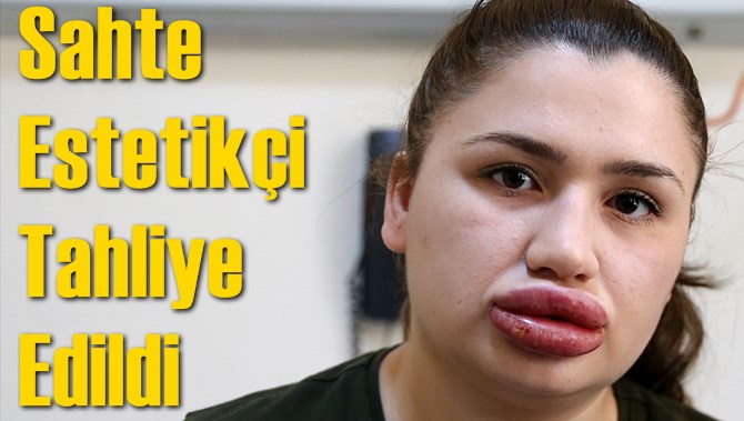 Sahte Estetik&ccedil;i Tahliye Edildi