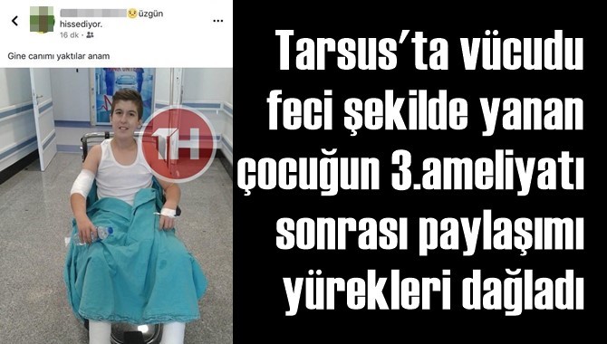 Tarsus'ta V&uuml;cudu Yanan &Ccedil;ocuğun Son Paylaşımı Y&uuml;rekleri Dağladı