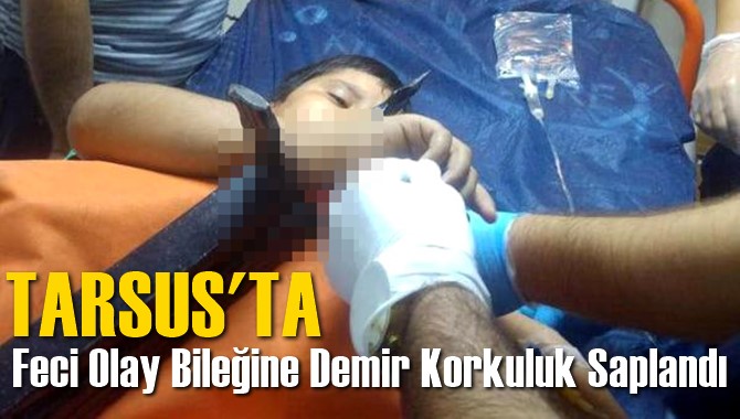 Tarsus'ta Feci Olay Bileğine Demir Korkuluk Saplandı
