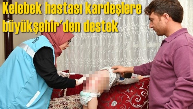Tarsuslu "kelebek hastası" kardeşlere b&uuml;y&uuml;kşehirden destek