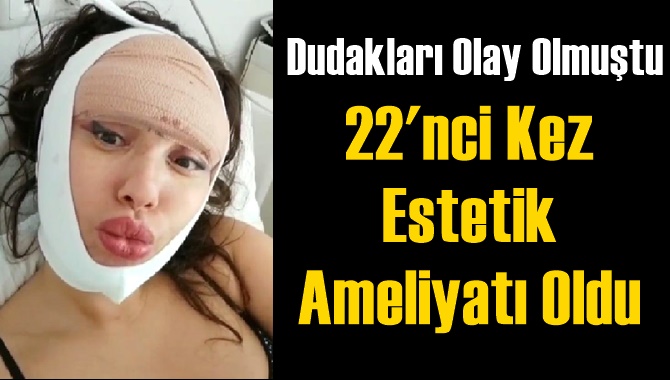 22'nci Kez Estetik Ameliyatı Oldu
